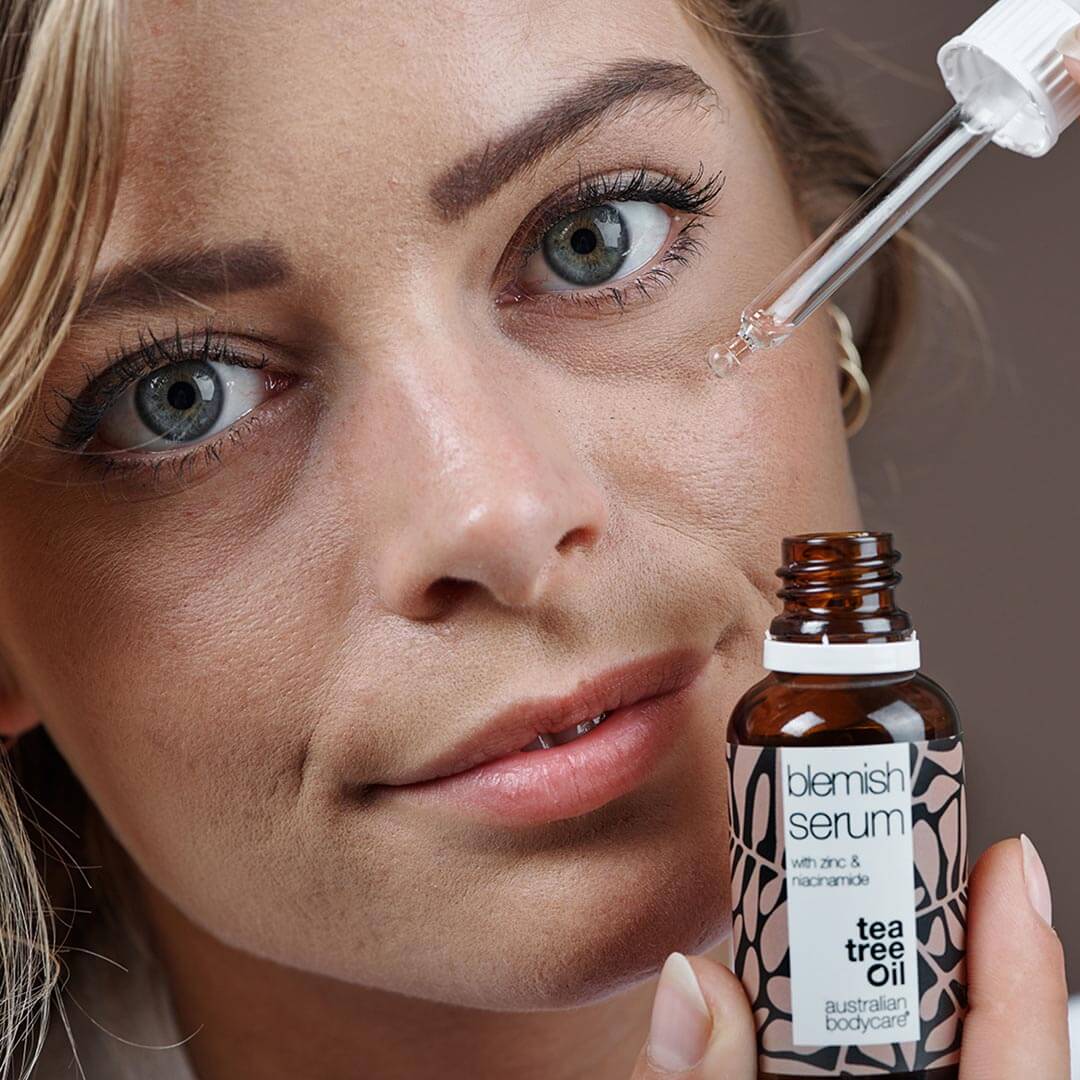 Niacinamide serum til bumser og uren hud — Med Niacinamid 10%, Zink 1% og Tea Tree Oil til uren & fedtet hud