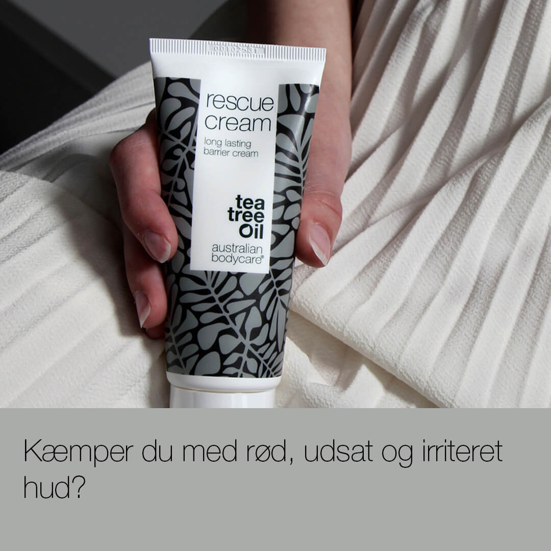 Barrierecreme — Barrierecreme ved irriteret og rød hud på kroppen