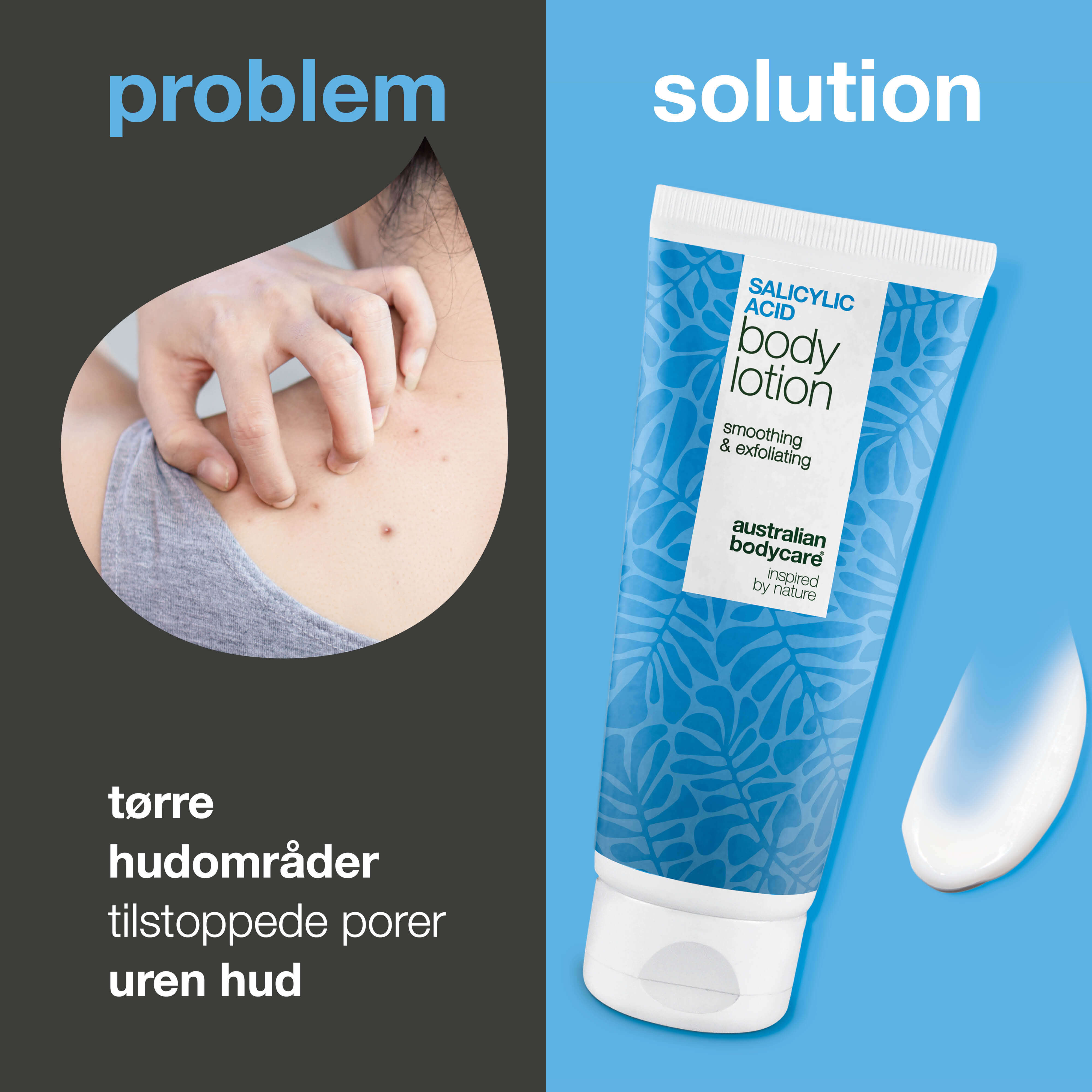 Bodylotion med salicylsyre – mod bumser og tør hud — Bodylotion med salicylsyre eksfolierer, fugter og reducerer bumser, uren hud og tørre områder. Perfekt til daglig hudpleje.