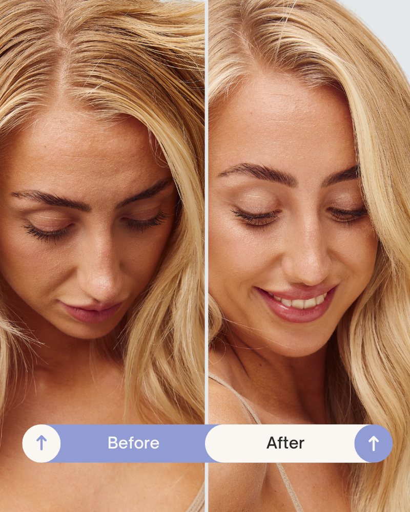 Refresh Powder™ Dry Shampoo