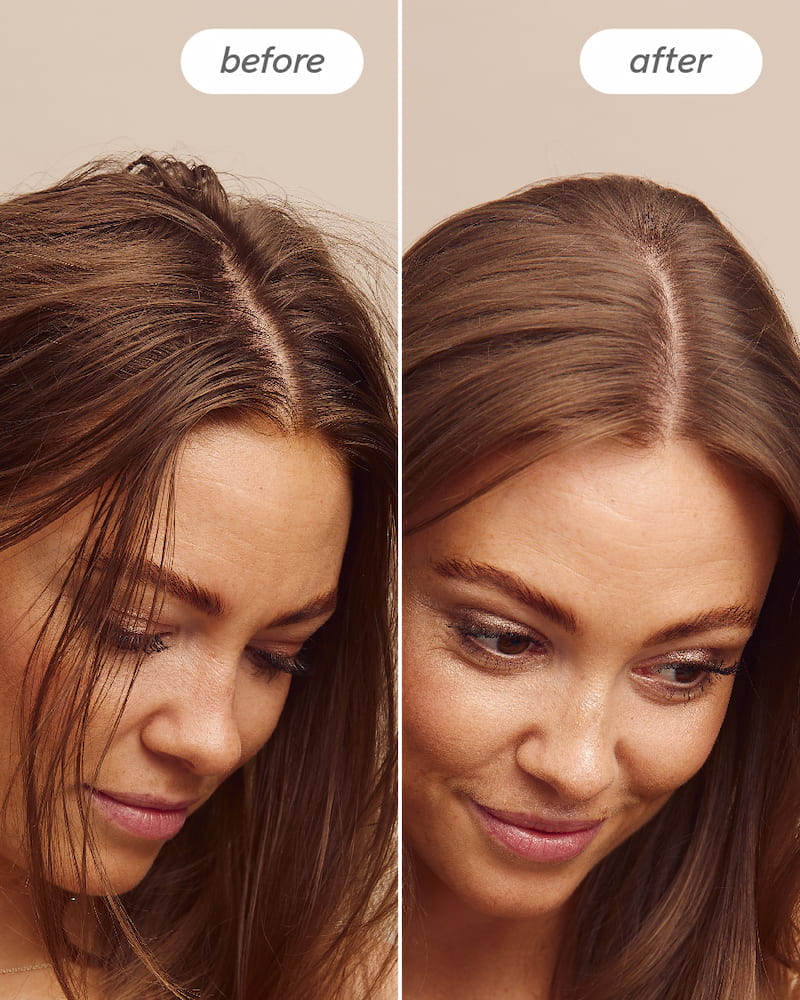 Scalp Delight™ Detox Conditioner